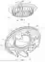 Fig. 04 - Pressure regulating valve gasket