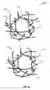 Fig. 04 - Process for extruding a porous substrate