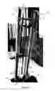Fig. 06 - Hand truck
