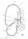 Fig. 03 - Air-bag occupant protection device