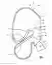 Fig. 04 - Air-bag occupant protection device