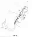 Fig. 02 - Cushion break stitch pattern