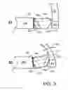 Fig. 05 - Impact force coupling assembly