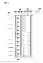 Fig. 03 - Light blocking layer, display filter having the light blocking layer, and display apparatus having the display filter