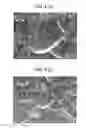 Fig. 05 - Magnetic encoder and bearing