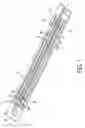 Fig. 02 - Inkjet jet stack external manifold