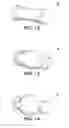 Fig. 12 - Rolling ink stick