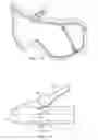 Fig. 08 - Lens replacement system