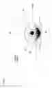 Fig. 02 - Hydrodynamically operated multifocal contact lens
