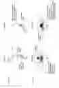 Fig. 05 - Hydrodynamically operated multifocal contact lens