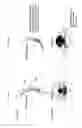 Fig. 06 - Hydrodynamically operated multifocal contact lens