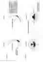 Fig. 08 - Hydrodynamically operated multifocal contact lens