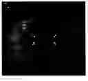 Fig. 01 - Determining optimal positioning of ophthalmic devices by use of image processing and autofocusing techniques