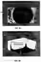 Fig. 07 - Determining optimal positioning of ophthalmic devices by use of image processing and autofocusing techniques