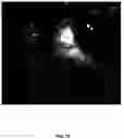 Fig. 13 - Determining optimal positioning of ophthalmic devices by use of image processing and autofocusing techniques