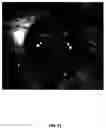 Fig. 14 - Determining optimal positioning of ophthalmic devices by use of image processing and autofocusing techniques