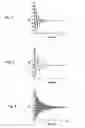 Fig. 04 - Magnetic head