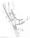 Fig. 15 - Uni-Body Power Tool