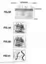 Fig. 32 - Endoscope apparatus