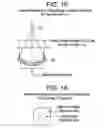 Fig. 12 - X-RAY CT APPARATUS