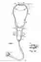 Fig. 02 - Electronic stethoscope
