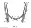 Fig. 12 - Electronic stethoscope