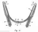 Fig. 13 - Electronic stethoscope