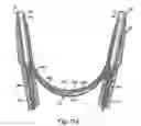 Fig. 14 - Electronic stethoscope