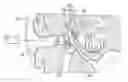 Fig. 01 - Implantable hearing aid