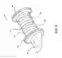 Fig. 05 - Implantable hearing aid