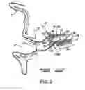 Fig. 03 - Hearing aid protective packaging assembly
