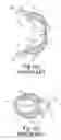 Fig. 03 - Headphone device