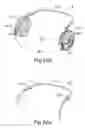 Fig. 04 - Headphone device