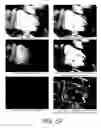 Fig. 32 - Image Processing Using Rear View Mirror-Mounted Imaging Device