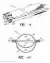 Fig. 02 - Conduit insert for optical fiber cable
