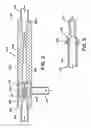 Fig. 03 - Method and apparatus for deactivating a medical instrument of biocontamination