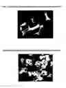 Fig. 02 - Insulin highly respirable microparticles