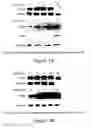 Fig. 02 - Use of eIF-5A to kill multiple myeloma cells