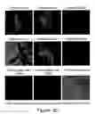 Fig. 35 - Use of eIF-5A to kill multiple myeloma cells