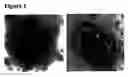 Fig. 02 - Modified whole cell, cell extract and omv-based vaccines