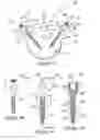 Fig. 05 - Therapeutic Structures