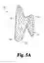 Fig. 06 - Implantable graft material