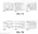 Fig. 06 - Polymer having interconnected pores for drug delivery and method