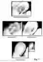 Fig. 04 - Compositions comprising vitamins and/or derivatives thereof stablished with olea europea extract and/or ionene polymers