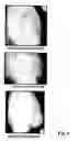 Fig. 05 - Compositions comprising vitamins and/or derivatives thereof stablished with olea europea extract and/or ionene polymers