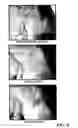 Fig. 07 - Compositions comprising vitamins and/or derivatives thereof stablished with olea europea extract and/or ionene polymers