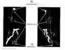 Fig. 01 - Augmentation of intraluminal microvessel formation to facilitate guide wire crossing in chronic total occlusions