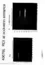 Fig. 22 - Augmentation of intraluminal microvessel formation to facilitate guide wire crossing in chronic total occlusions