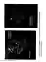 Fig. 28 - Augmentation of intraluminal microvessel formation to facilitate guide wire crossing in chronic total occlusions
