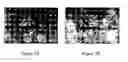 Fig. 09 - Bone matrix compositions and methods